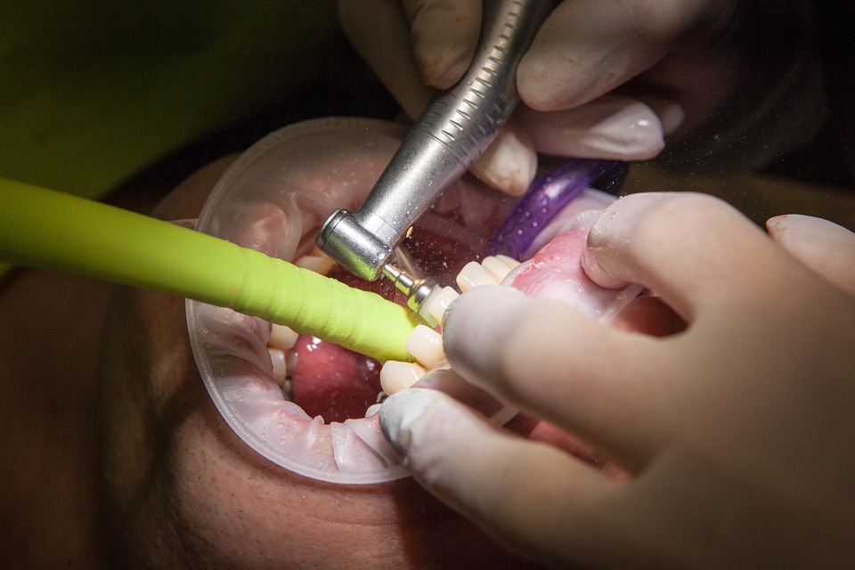 dental procedure